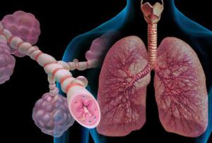 유형, 발병 기원, 병인 발생 요인에 따른 호흡 부전의 분류